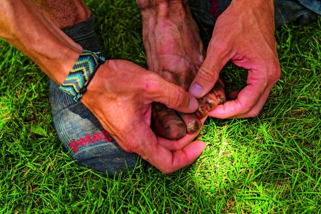 The Foot Treatment An Ultrarunner Says Is Crucial