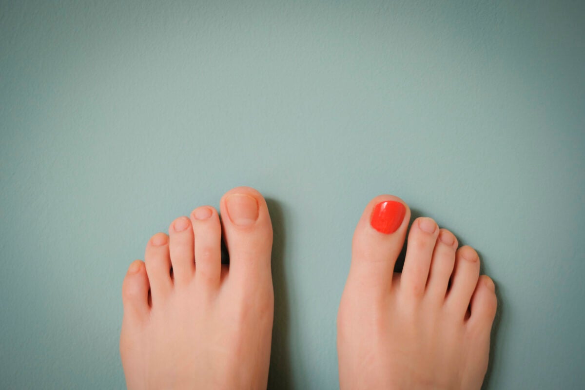 How To Prevent Black Toenails (Or Hide Them With Nail Polish) Women's Running