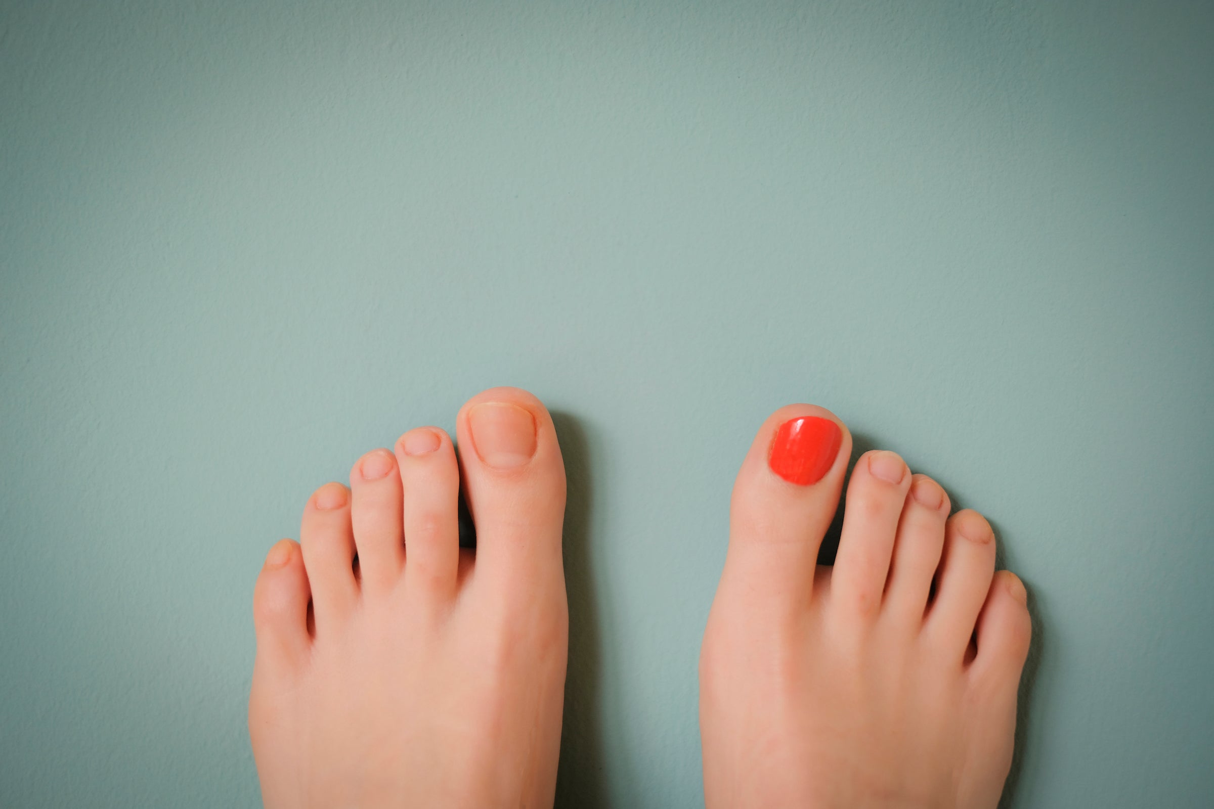 What's Causing The Black Spot Beneath My Nail? – My FootDr
