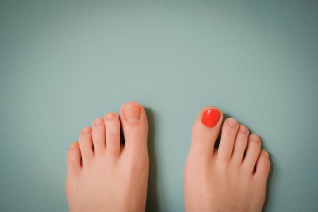 How To Prevent Black Toenails (Or Hide Them With Nail Polish)