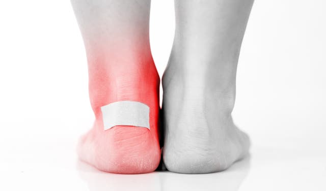 Pop It Or Pad It? The 9-Step Blister Fix