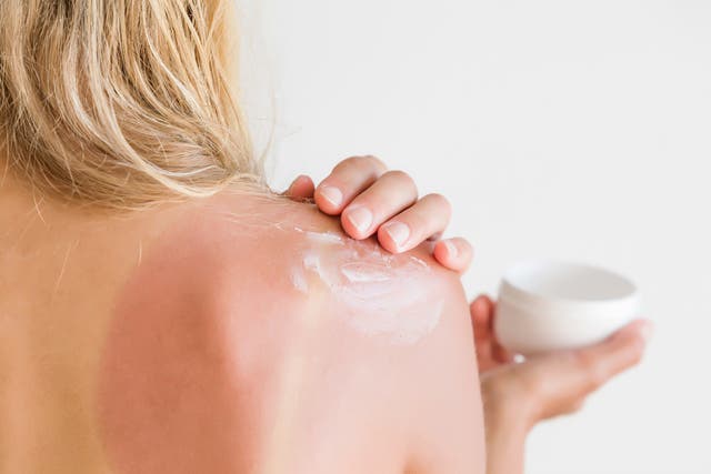 How to Sleep Easier When You Have a Sunburn