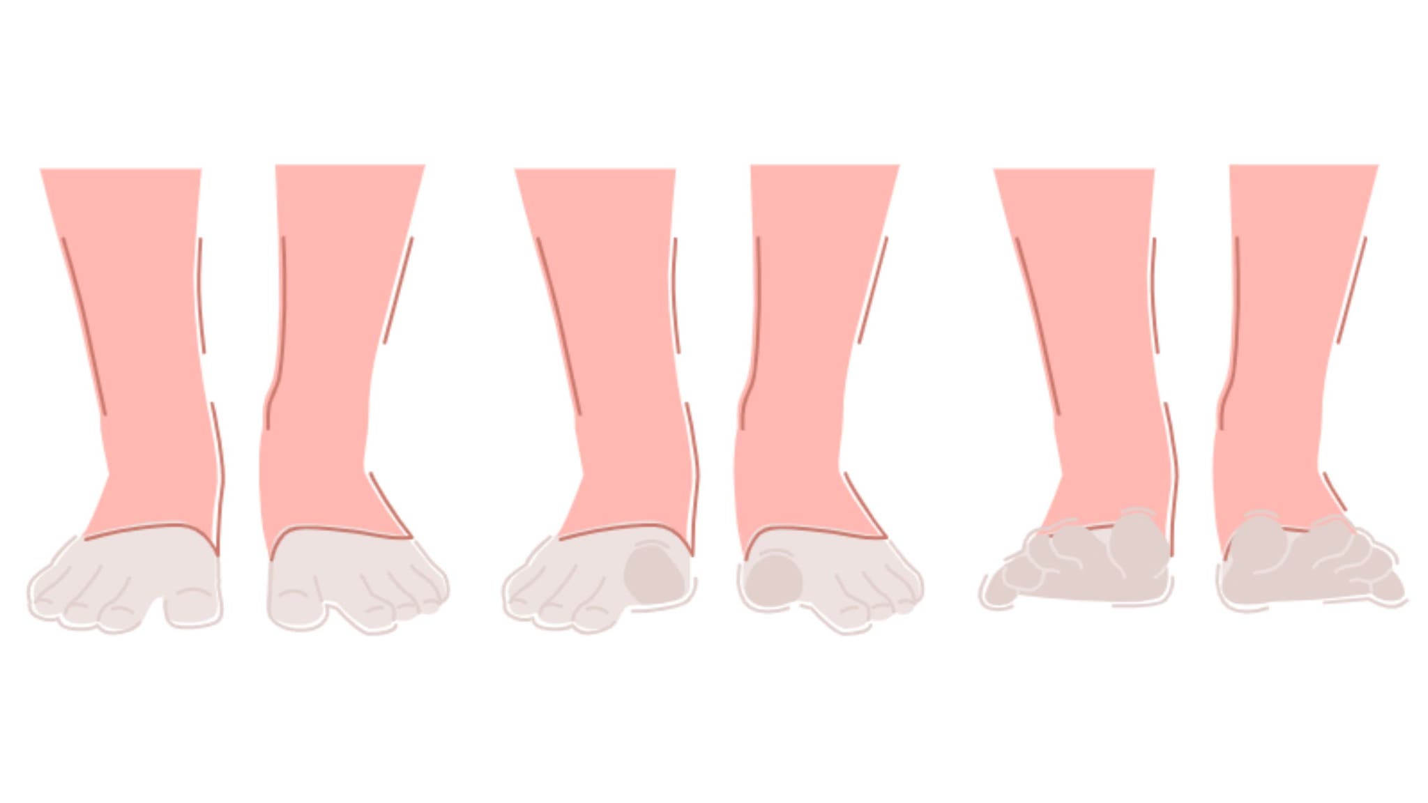Active Toe Mobility