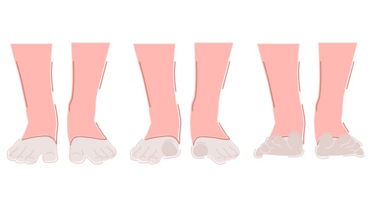 Active Toe Mobility