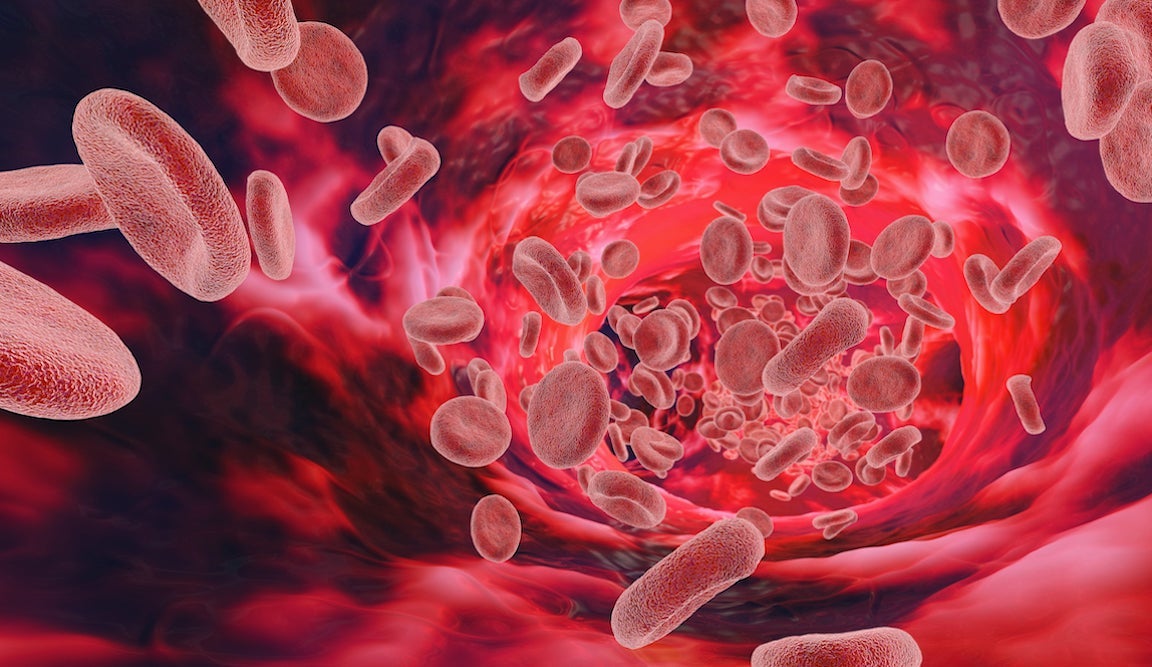 Red blood cells travel through a vessel in this medical illustration